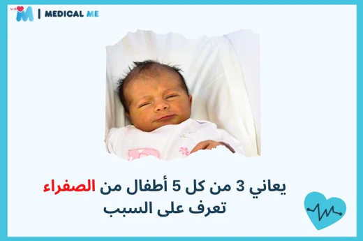 الصفراء عند الأطفال