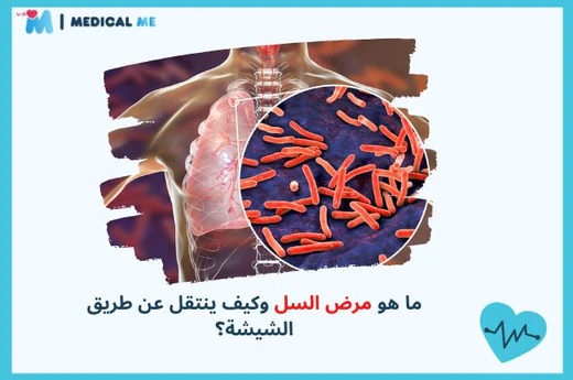Tuberculosis Disease