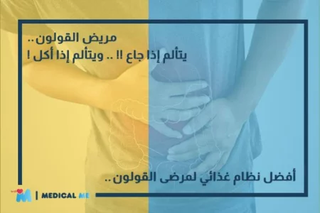 القولون العصبي